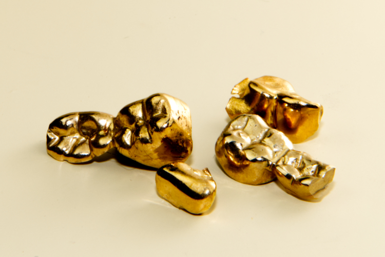 Zubno zlato Zubno zlato