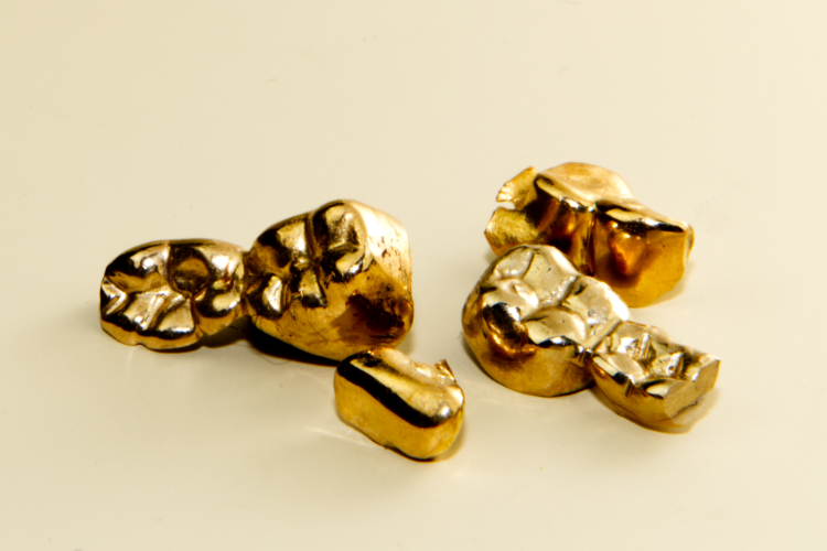 Zahngold Dentalgold