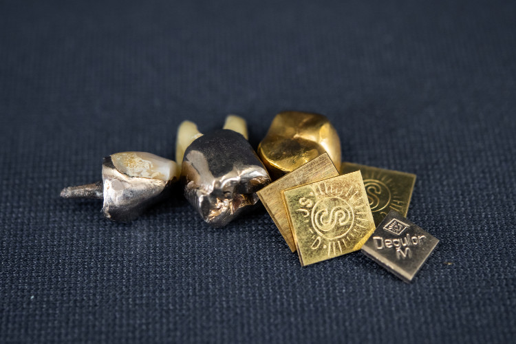 Goldzähne und Zahngoldplättchen